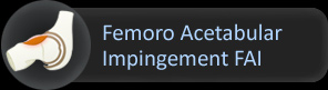 Femoro Acetabular Impingement FAI, Saint Louis, Missouri
