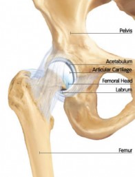 Hip Impingement, Saint Louis, Missouri