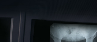 King Orthopedics Orthopedic Associates, Saint Louis, MO